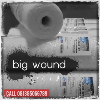 d Big Wound Cartridge Filter Indonesia  large2